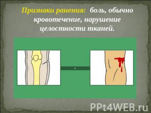 Признаки ранения: боль, обычно кровотечение, нарушение целостности тканей.