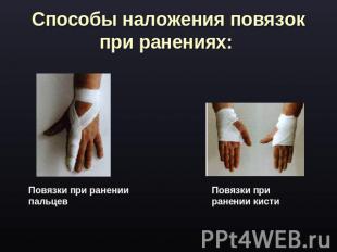 Способы наложения повязок при ранениях: Повязки при ранении пальцев Повязки при