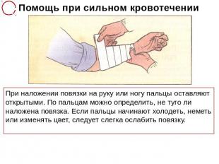 Помощь при сильном кровотечении При наложении повязки на руку или ногу пальцы ос