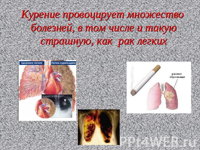 Курение провоцирует множество болезней, в том числе и такую страшную, как рак легких
