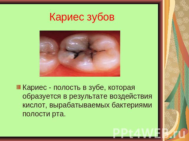 Кариес зубов Кариес - полость в зубе, которая образуется в результате воздействия кислот, вырабатываемых бактериями полости рта.