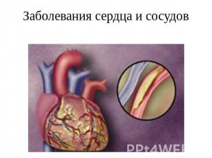 Заболевания сердца и сосудов