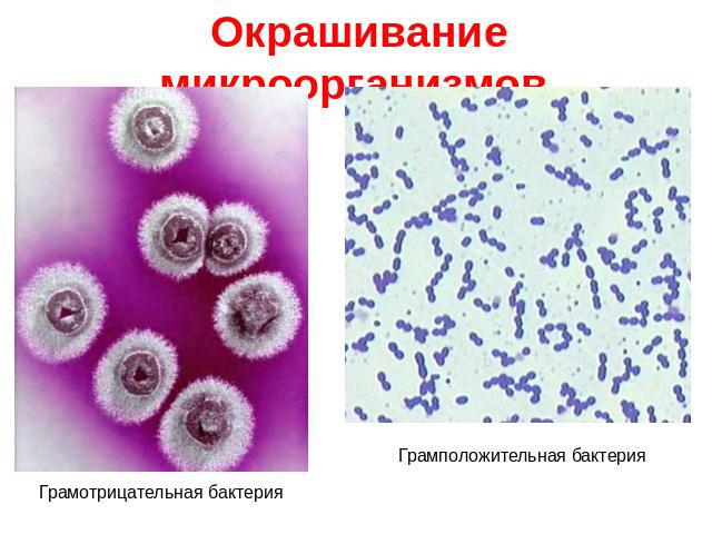 Окрашивание микроорганизмов. Грамотрицательная бактерия Грамположительная бактерия