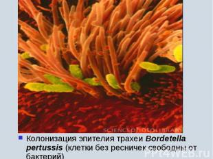 Колонизация эпителия трахеи Bordetella pertussis (клетки без ресничек свободны о