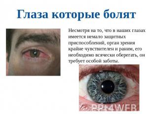 Глаза которые болят Несмотря на то, что в наших глазах имеется немало защитных п