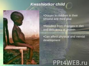 Kwashiorkor child Occurs in children in their second and third yearResulted from
