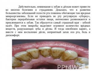 Действительно, невнимание к зубам и дёснам может привести ко многим болезням и с
