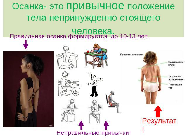 Осанка- это привычное положение тела непринужденно стоящего человека. Правильная осанка формируется до 10-13 лет. Неправильные привычки!
