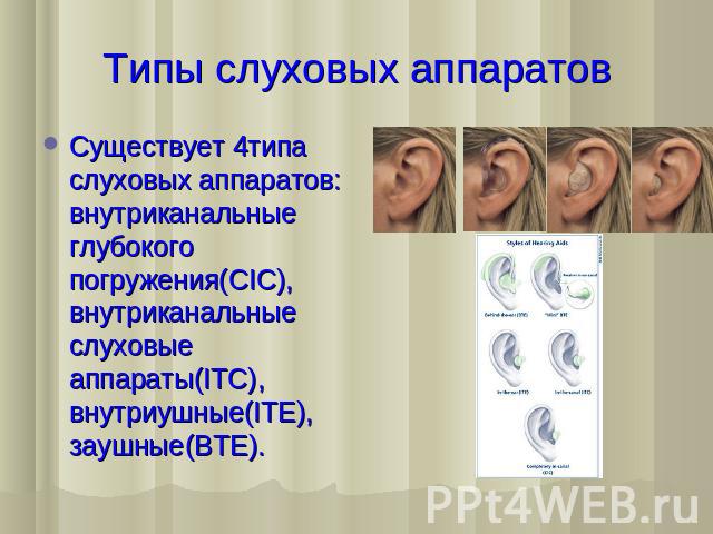 Типы слуховых аппаратов Существует 4типа слуховых аппаратов: внутриканальные глубокого погружения(CIC), внутриканальные слуховые аппараты(ITC), внутриушные(ITE), заушные(BTE).