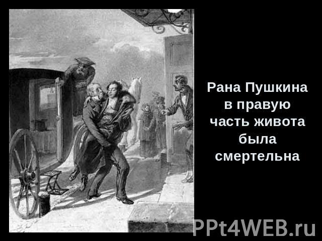 Рана Пушкина в правую часть живота была смертельна