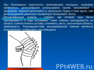 При бинтовании конечности неодинаковой толщины, например предплечья, целесообраз