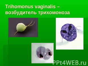 Trihomonus vaginalis – возбудитель трихомоноза