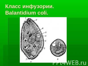 Класс инфузории. Balantidium coli.