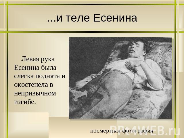 ...и теле Есенина Левая рука Есенина была слегка поднята и окостенела в непривычном изгибе. посмертная фотография