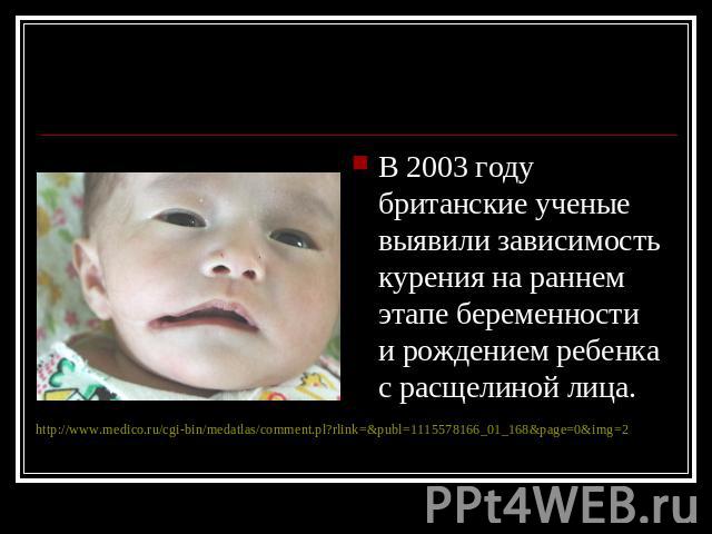 В 2003 году британские ученые выявили зависимость курения на раннем этапе беременности и рождением ребенка с расщелиной лица.
