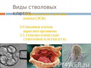 Виды стволовых клеток Эмбриональные стволовые клетки (ЭСК) 2.Стволовые клетки вз