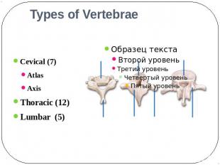 Types of Vertebrae Cevical (7)AtlasAxis Thoracic (12)Lumbar (5)