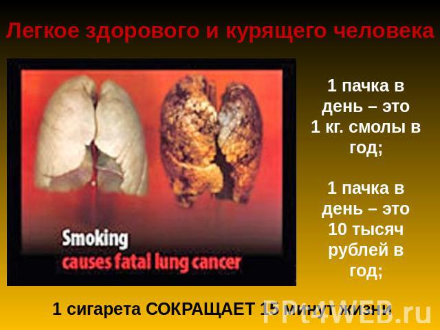 Легкое здорового и курящего человека 1 пачка в день – это 1 кг. смолы в год; 1 пачка в день – это 10 тысяч рублей в год; 1 сигарета СОКРАЩАЕТ 15 минут жизни
