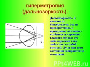 гиперметропия (дальнозоркость). Дальнозоркость. В отличие от близорукости, это н