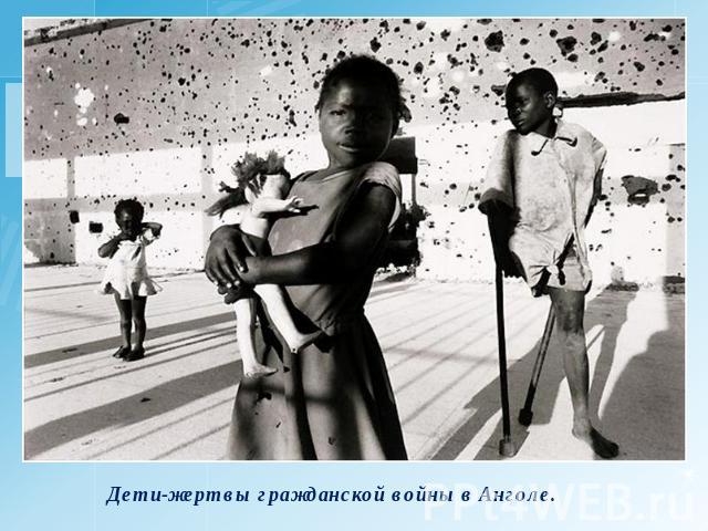 Дети-жертвы гражданской войны в Анголе.