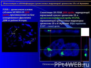 Визуализация и идентификация хромосомных территорий хромосомы 18 и её деривата F