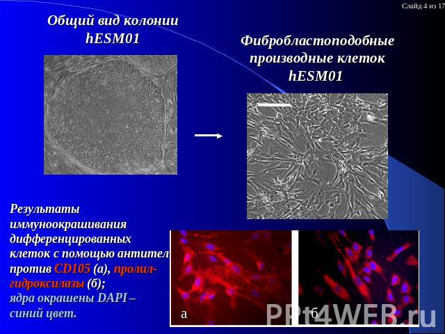 Общий вид колонии hESM01 Результаты иммуноокрашивания дифференцированных клеток с помощью антител против CD105 (a), пролил-гидроксилазы (б);ядра окрашены DAPI – синий цвет. Фибробластоподобные производные клеток hESM01