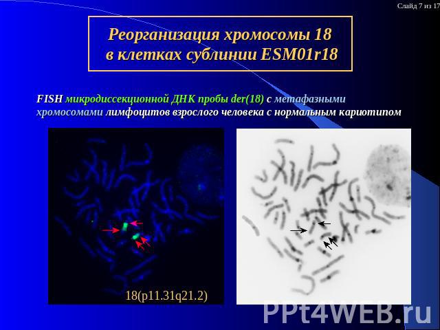 Реорганизация хромосомы 18 в клетках сублинии ESM01r18 FISH микродиссекционной ДНК пробы der(18) c метафазными хромосомами лимфоцитов взрослого человека с нормальным кариотипом