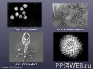 Вирус полиомиелита Вирус бактериофага Вирус табачной мозаики Вирус герпеса
