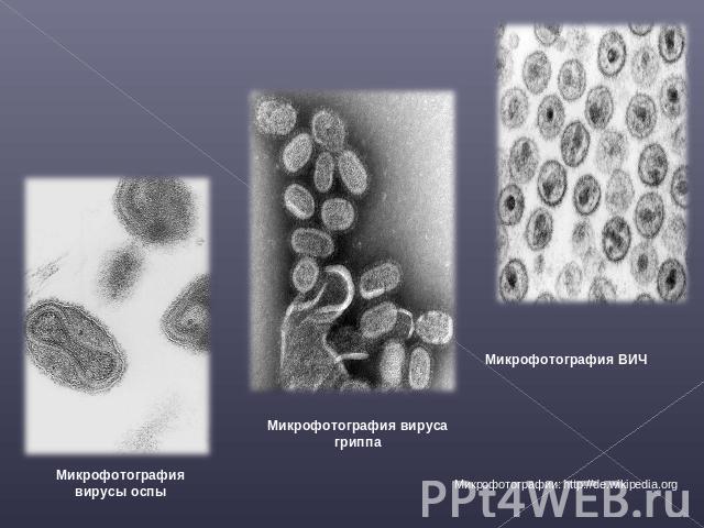 Микрофотография вирусы оспы Микрофотография вируса гриппа Микрофотография ВИЧ