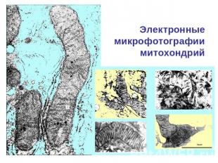 Электронные микрофотографии митохондрий