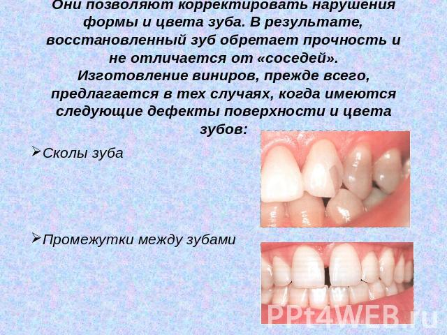 Они позволяют корректировать нарушения формы и цвета зуба. В результате, восстановленный зуб обретает прочность и не отличается от «соседей».Изготовление виниров, прежде всего, предлагается в тех случаях, когда имеются следующие дефекты поверхности …
