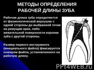 МЕТОДЫ ОПРЕДЕЛЕНИЯ РАБОЧЕЙ ДЛИНЫ ЗУБА Рабочая длина зуба определяется от физиоло