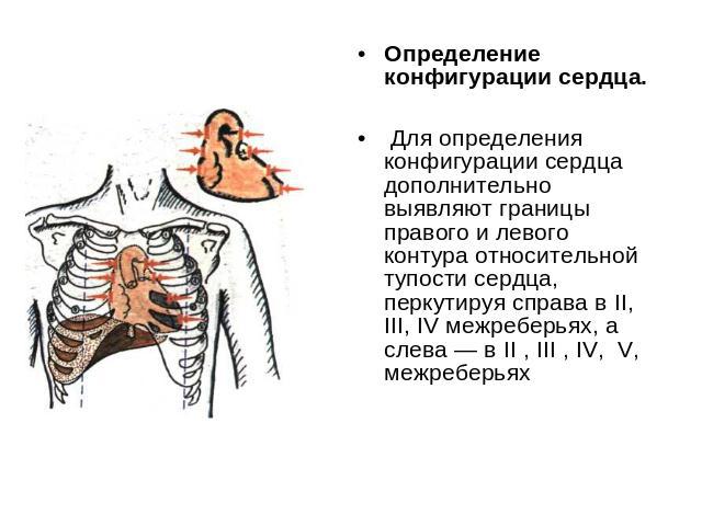 Определение конфигурации сердца. Для определения конфигурации сердца дополнительно выявляют границы правого и левого контура относительной тупости сердца, перкутируя справа в II, III, IV межреберьях, а слева — в II , III , IV, V, межреберьях