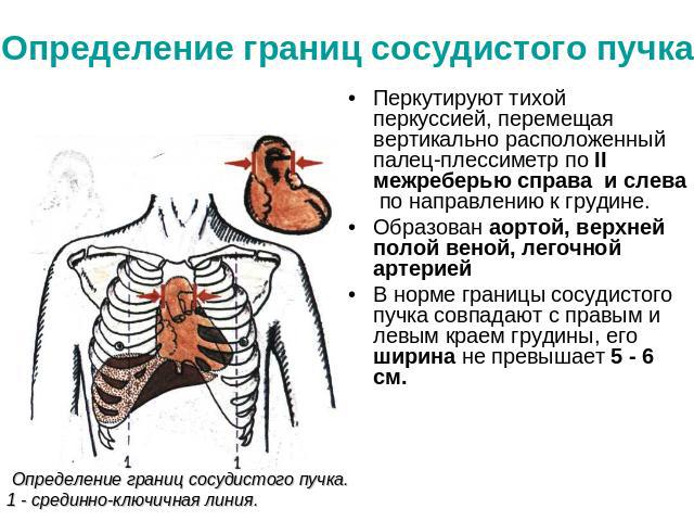 Определение границ сосудистого пучка Перкутируют тихой перкуссией, перемещая вертикально расположенный палец-плессиметр по II межреберью справа и слева по направлению к грудине. Образован аортой, верхней полой веной, легочной артериейВ норме границы…
