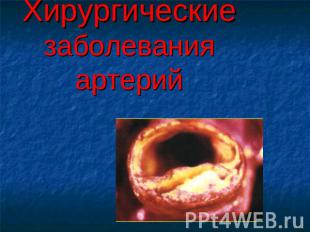 Хирургические заболевания артерий