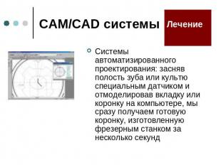 CAM/CAD системы Системы автоматизированного проектирования: засняв полость зуба