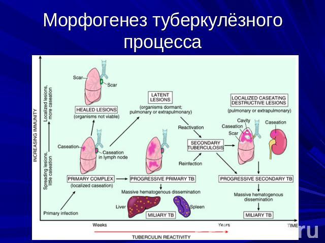 Морфогенез туберкулёзного процесса