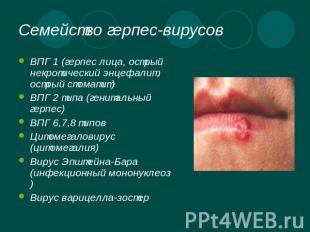 Семейство герпес-вирусов ВПГ 1 (герпес лица, острый некротический энцефалит, ост