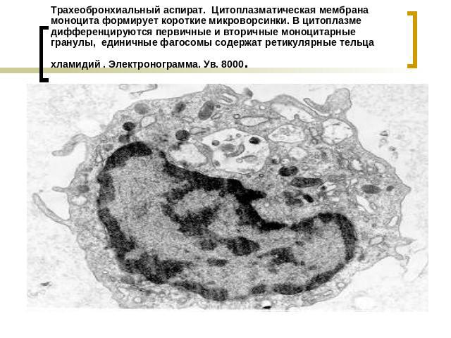 Трахеобронхиальный аспират. Цитоплазматическая мембрана моноцита формирует короткие микроворсинки. В цитоплазме дифференцируются первичные и вторичные моноцитарные гранулы, единичные фагосомы содержат ретикулярные тельца хламидий . Электронограмма. …