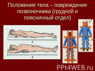 Положение тела – повреждение позвоночника (грудной и поясничный отдел)