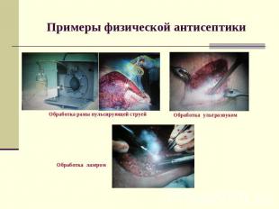 Примеры физической антисептики Обработка раны пульсирующей струей Обработка ульт