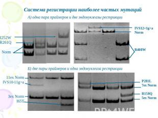 Система регистрации наиболее частых мутаций А) одна пара праймеров и две эндонук