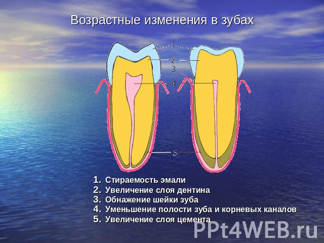 Возрастные изменения в зубах Стираемость эмалиУвеличение слоя дентинаОбнажение шейки зубаУменьшение полости зуба и корневых каналовУвеличение слоя цемента