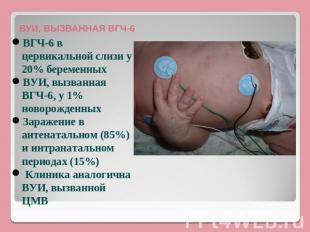 ВУИ, ВЫЗВАННАЯ ВГЧ-6 ВГЧ-6 в цервикальной слизи у 20% беременныхВУИ, вызванная В