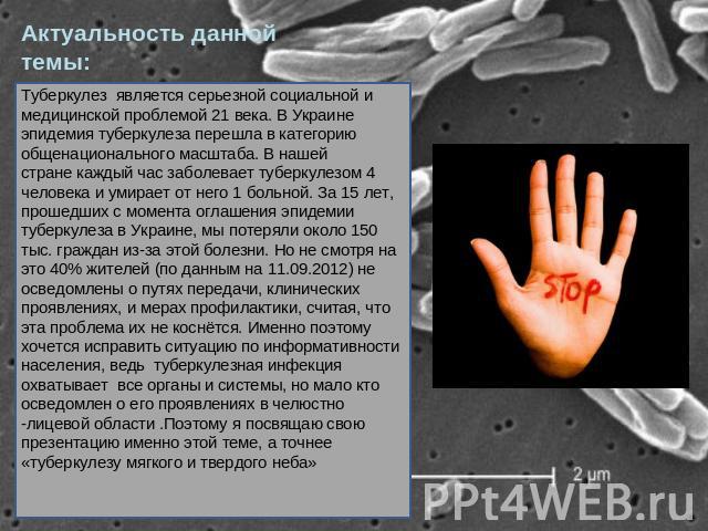 Актуальность данной темы: Туберкулез является серьезной социальной и медицинской проблемой 21 века. В Украине эпидемия туберкулеза перешла в категорию общенационального масштаба. В нашей стране каждый час заболевает туберкулезом 4 человека и умирает…