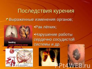 Последствия курения Выраженные изменения органов; Рак лёгких;Нарушение работы се