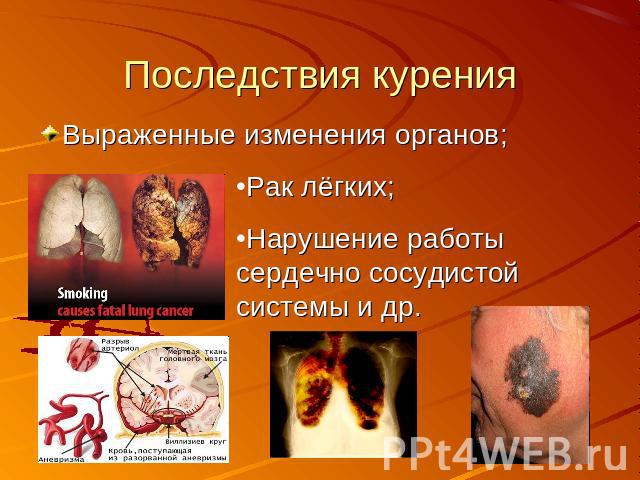 Последствия курения Выраженные изменения органов; Рак лёгких;Нарушение работы сердечно сосудистой системы и др.