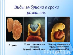 Виды эмбриона в сроки развития. 5 суток 22 дня - серым цветом обозначен будущий