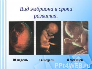 Вид эмбриона в срокиразвития. 10 недель 14 недель 8 месяцев