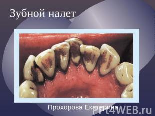 Зубной налет Прохорова Екатерина
